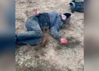 Ит 15 жасар баланың екі қолын шайнап тастаған