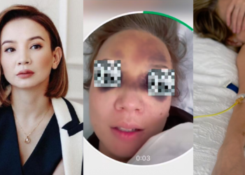 «Тірі қалғаныма шүкір» — Тележүргізуші Әйкерім Есенәлі ауыр жарақат алды