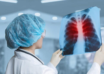 Туберкулез аурушаңдығы төмендеді